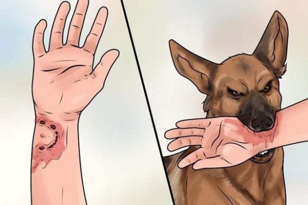 Triệu chứng chó dại cắn – sơ cứu khi bị chó cắn